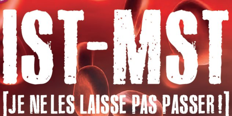 ist mst
