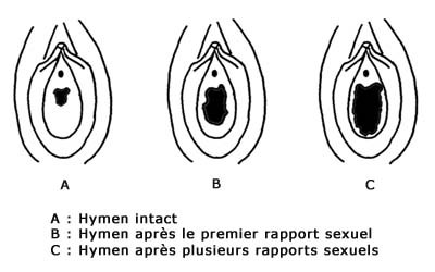 comment ne plus etre vierge